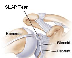 slap-tear-1